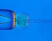 Was ist eine Stammzelle? Wo will die Medizin embryonales Zellmaterial einsetzen? Woran arbeiten die Forscher derzeit fieberhaft? Warum beschftigt sich der Bundestag intensiv mit dem Thema? Wie erklren die Bedeutung des umstrittenen embryonalen Zellmaterials.